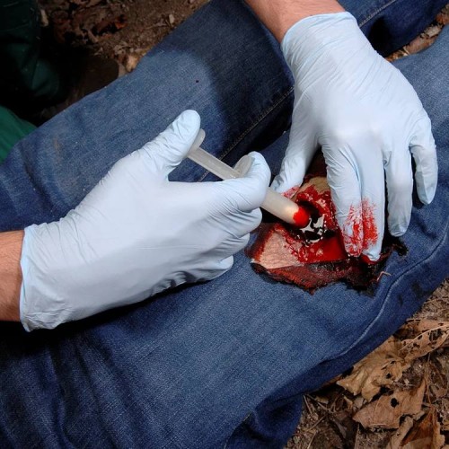 Аппликатор гемостатический с гранулами Rhino Rescue в Ярославле хитозановый